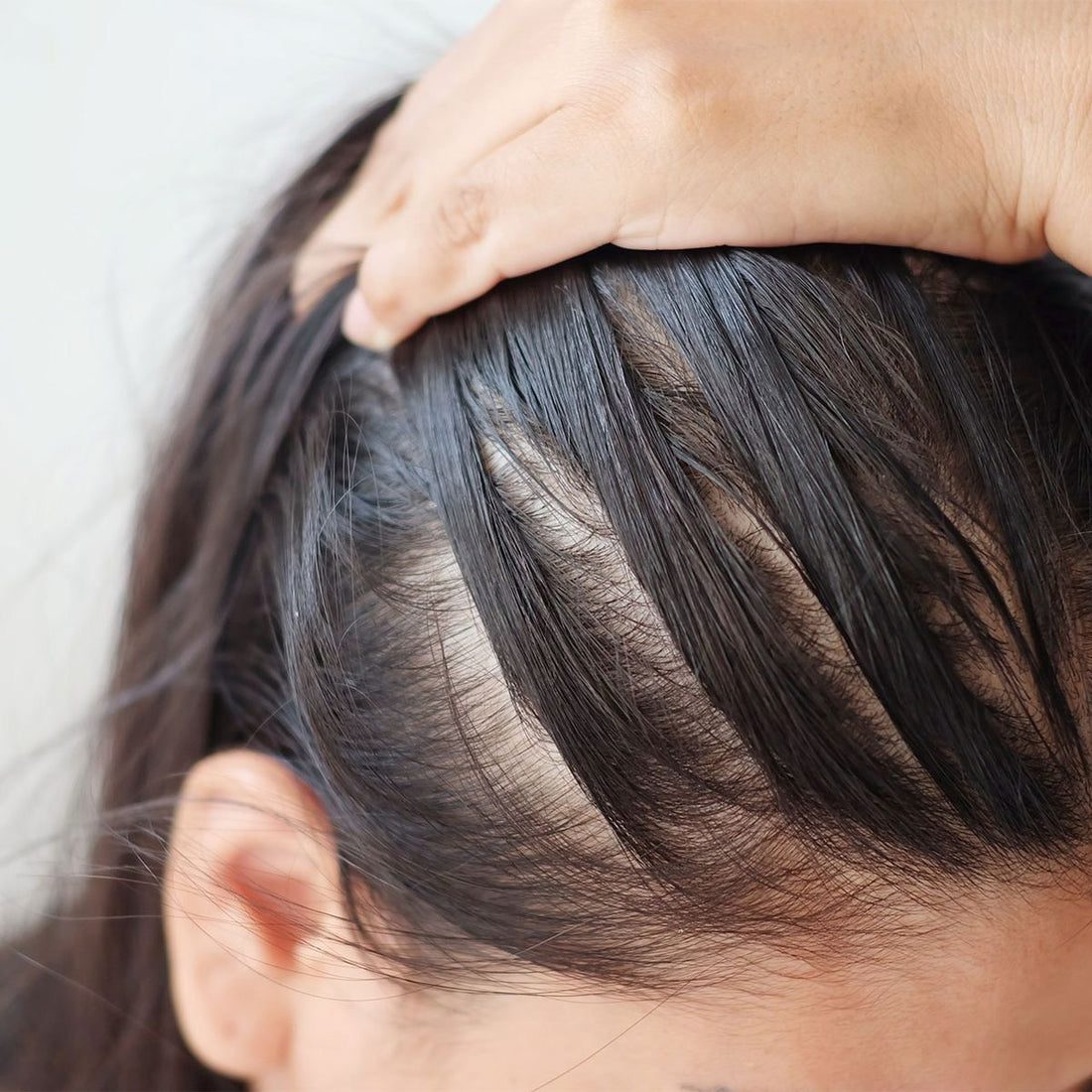 ¿Por qué se cae el cabello?