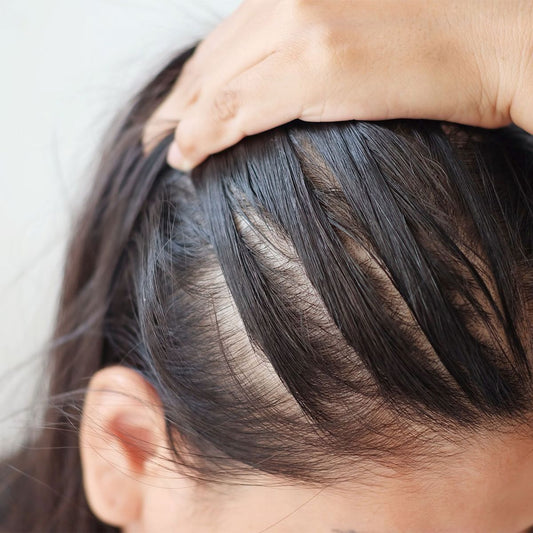 ¿Por qué se cae el cabello?